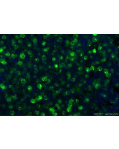 Anti-Human CD83 (HB15e) Mouse IgG2a Recombinant Antibody proteintech 65581-1-MR