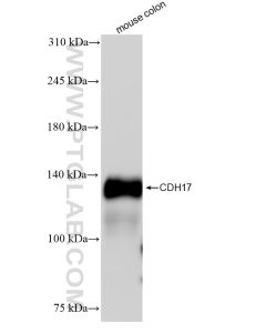 Cadherin-17 Recombinant monoclonal antibody proteintech 83793-5-RR