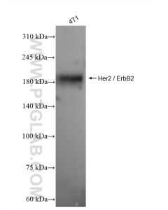 HER2/ErbB2 Recombinant monoclonal antibody proteintech 84128-5-RR