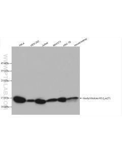 Acetyl-Histone H3 (Lys27) Recombinant monoclonal antibody proteintech 82902-1-RR