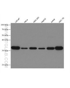 S6 Ribosomal protein Recombinant monoclonal antibody proteintech 80208-1-RR