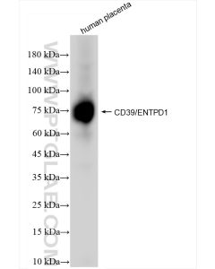 CD39/ENTPD1 Recombinant monoclonal antibody proteintech 84235-4-RR