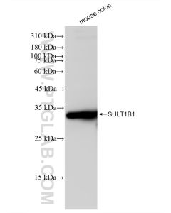 SULT1B1 Recombinant monoclonal antibody proteintech 83228-1-RR
