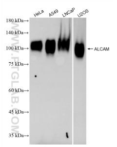 ALCAM Recombinant monoclonal antibody proteintech 86811-3-RR