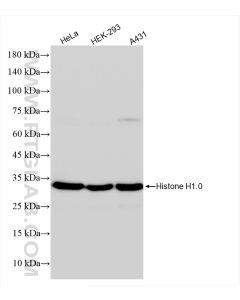 Histone H1.0 Recombinant monoclonal antibody proteintech 83993-1-RR