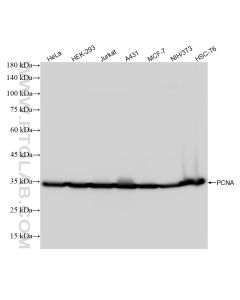 PCNA Recombinant monoclonal antibody proteintech 81302-6-RR