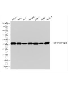 HSP47/SERPINH1 Recombinant monoclonal antibody proteintech 83689-4-RR