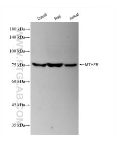 MTHFR Recombinant monoclonal antibody proteintech 83372-7-RR