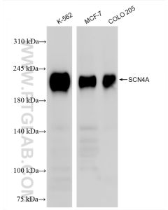 SCN4A Recombinant monoclonal antibody proteintech 85698-1-RR
