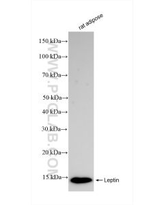 Leptin Recombinant monoclonal antibody proteintech 83655-3-RR