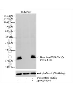 Phospho-4EBP1 (Thr37) Recombinant monoclonal antibody proteintech 81812-4-RR
