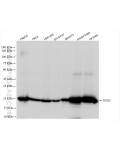 SOD2 Recombinant monoclonal antibody proteintech 83519-4-RR