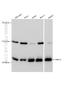 RNF31 / HOIP Recombinant monoclonal antibody proteintech 83137-4-RR