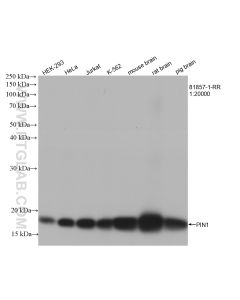 PIN1 Recombinant monoclonal antibody proteintech 81857-1-RR