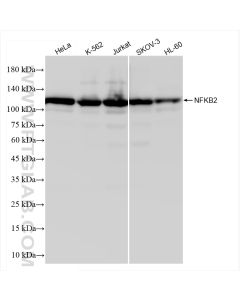 NFKB2,p100 Recombinant monoclonal antibody proteintech 84022-5-RR