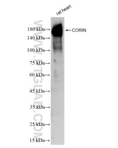 CORIN Recombinant monoclonal antibody proteintech 83566-1-RR