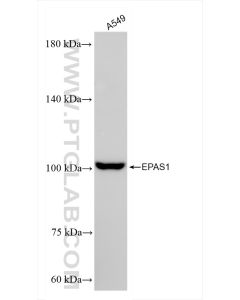 HIF2α/EPAS1 Recombinant monoclonal antibody proteintech 83790-1-RR
