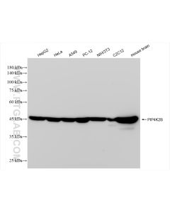 PIP4K2B Recombinant monoclonal antibody proteintech 83647-3-RR