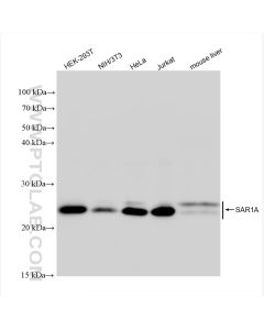 SAR1A Recombinant monoclonal antibody proteintech 83168-6-RR