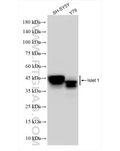 Islet 1 Recombinant monoclonal antibody proteintech 83784-4-RR