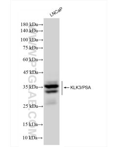 KLK3/PSA Recombinant monoclonal antibody proteintech 84059-5-RR