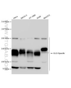GLI2-Specific Recombinant monoclonal antibody proteintech 84141-1-RR