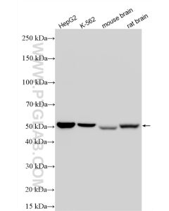 ALDH1B1 Recombinant monoclonal antibody proteintech 85426-2-RR