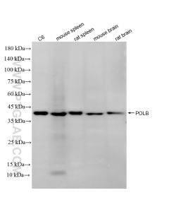 POLB Recombinant monoclonal antibody proteintech 86680-2-RR