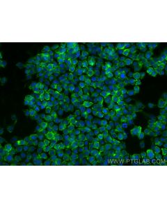 Anti-Human CD13 (WM15) Mouse IgG2a Recombinant Antibody proteintech 65633-1-MR