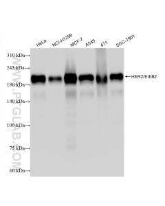 HER2/ErbB2 Recombinant monoclonal antibody proteintech 84046-1-RR