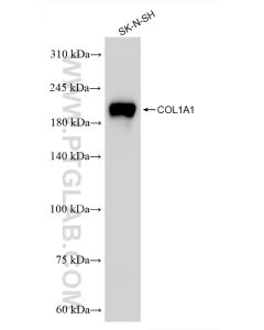 Collagen Type I Recombinant monoclonal antibody proteintech 86093-1-RR