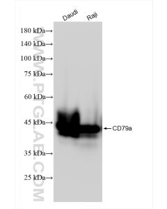 CD79a Recombinant monoclonal antibody proteintech 84236-5-RR