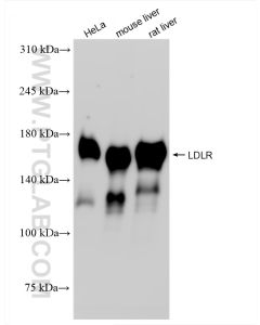 LDLR Recombinant monoclonal antibody proteintech 82724-1-RR