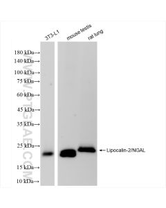Lipocalin-2/NGAL Recombinant monoclonal antibody proteintech 83853-2-RR