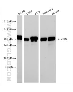 MRC2 Recombinant monoclonal antibody proteintech 86028-1-RR