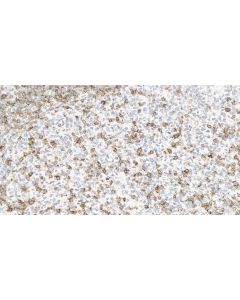 Anti-Human CD45RO (UCHL1) Mouse IgG2a Recombinant Antibody proteintech 65613-1-MR