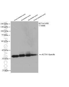 ACTA1-Specific Recombinant monoclonal antibody proteintech 82714-5-RR
