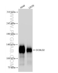 DCBLD2 Recombinant monoclonal antibody proteintech 85000-4-RR