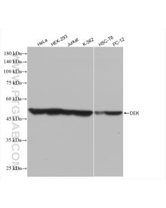 DEK Recombinant monoclonal antibody proteintech 82880-1-RR