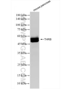 Thyroid Hormone Receptor beta Recombinant monoclonal antibody proteintech 83866-2-RR