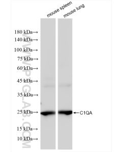 C1QA Recombinant monoclonal antibody proteintech 85719-4-RR