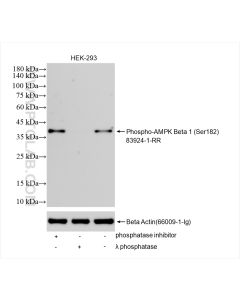 Phospho-AMPK Beta 1 (Ser182) Recombinant monoclonal antibody proteintech 83924-1-RR