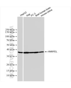 HNRPDL Recombinant monoclonal antibody proteintech 83129-5-RR