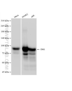 Endoglin/CD105 Recombinant monoclonal antibody proteintech 82993-6-RR