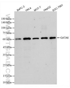 GATA6 Recombinant monoclonal antibody proteintech 84987-5-RR