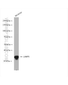 LAMP5 Recombinant monoclonal antibody proteintech 82992-2-RR