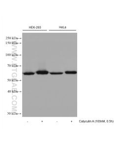 AKT1-Specific Recombinant monoclonal antibody proteintech 80457-1-RR
