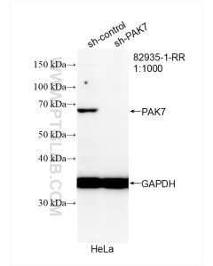 PAK7 Recombinant monoclonal antibody proteintech 82935-1-RR