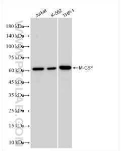 M-CSF Recombinant monoclonal antibody proteintech 84481-4-RR