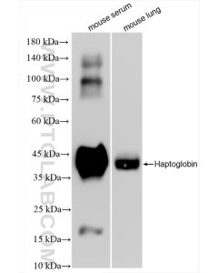 Haptoglobin Recombinant monoclonal antibody proteintech 83702-5-RR